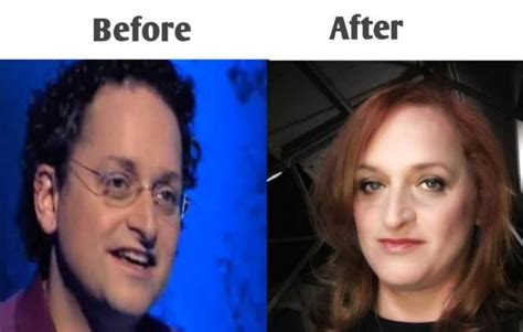 lynette nusbacher|lynette nusbacher before and after.